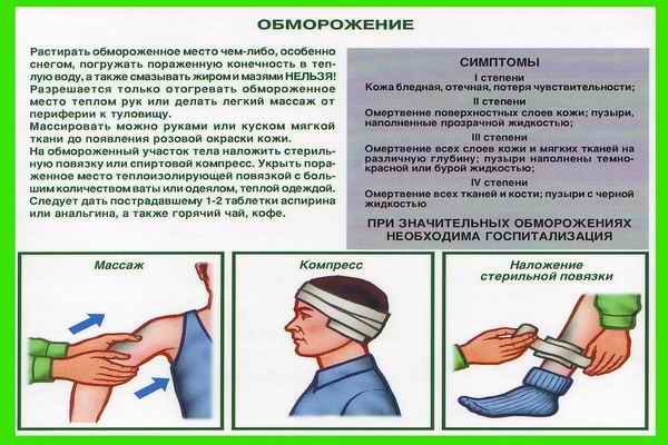 Что делать при обморожение в домашних условиях Что делать при обморожение в домашних условиях