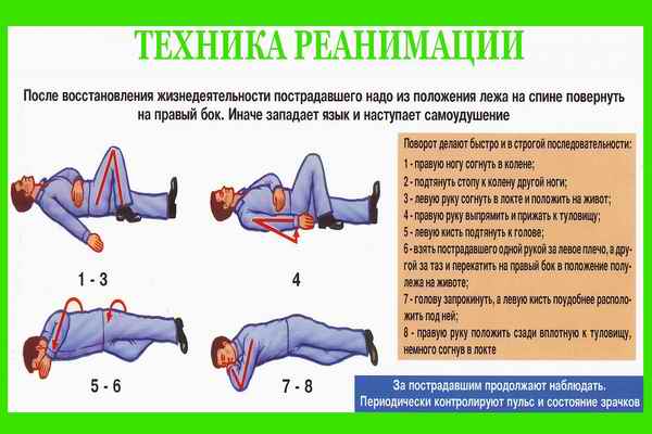 Положение пострадавшего при шоке. Техника реанимации. Техника реанимации в картинках. Стенд техника реанимации. Техника реанимации пострадавшего.